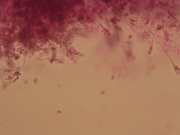 Penicillium Slides - Penicillium 03 400X